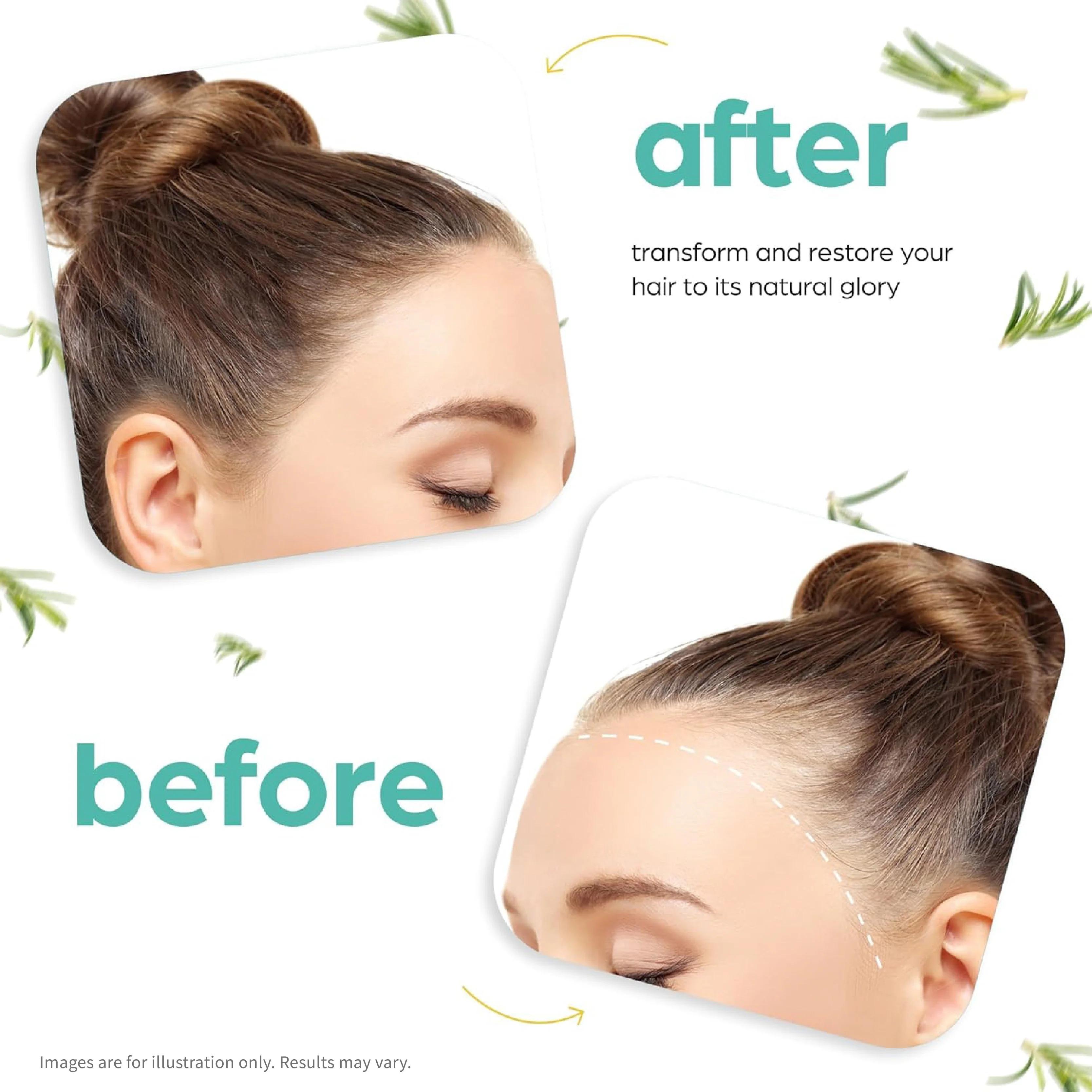 Hair Growth KIt