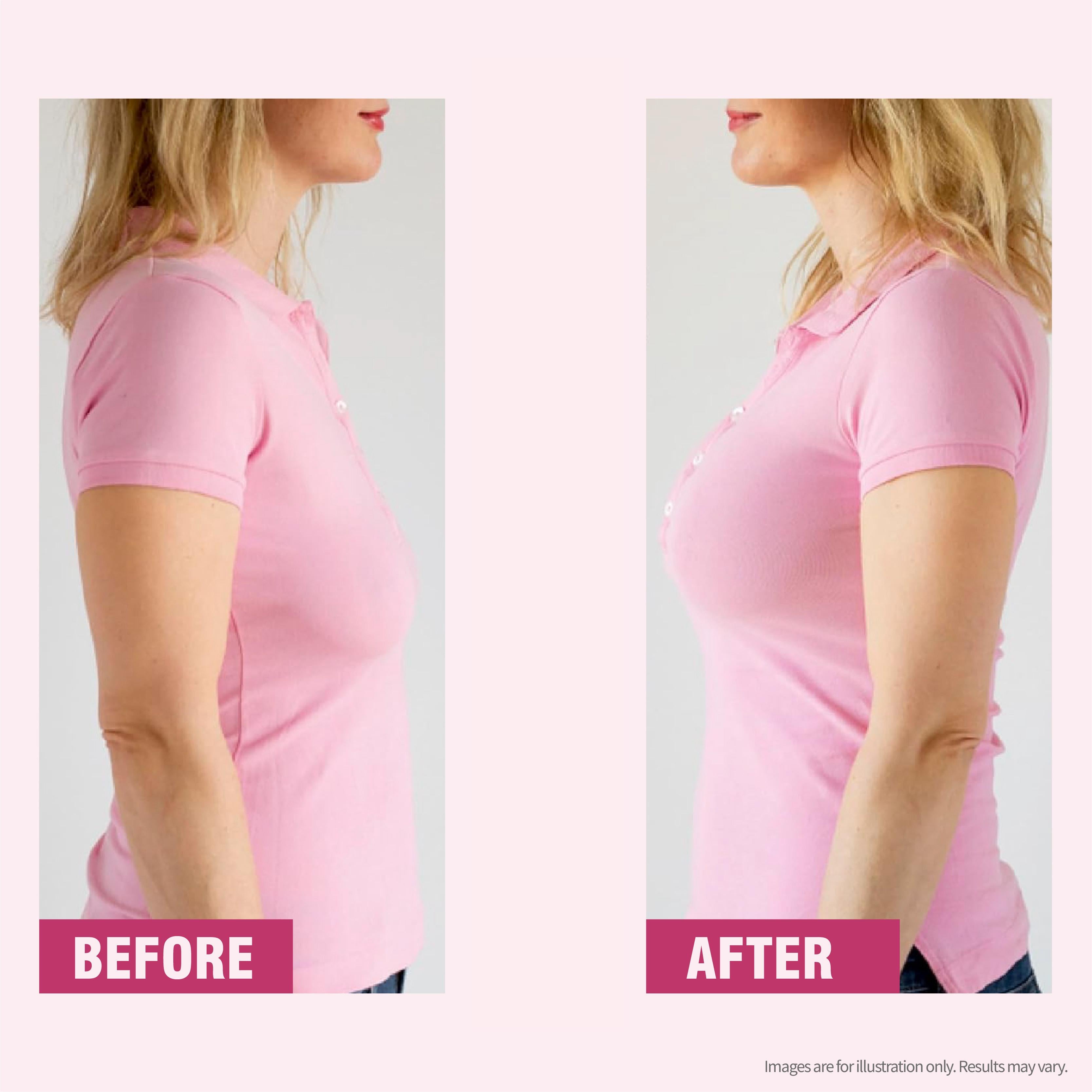 Breast Growth Kit